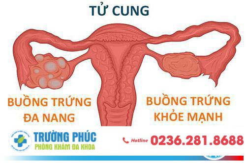 Chậm kinh có phải chuyện bình thường? Chậm kinh có phải chuyện bình thường?