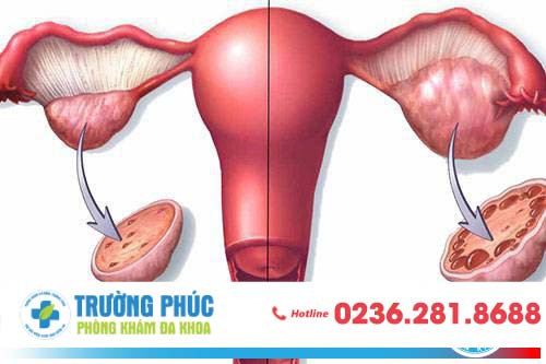 Chị em bị tắc kinh vấn đề không thể xem thường Chị em bị tắc kinh vấn đề không thể xem thường