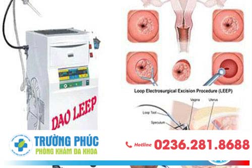 Chị em bị tắc kinh vấn đề không thể xem thường Chị em bị tắc kinh vấn đề không thể xem thường