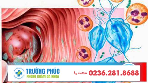 Những bệnh âm đạo mà chị em dễ mắc phải