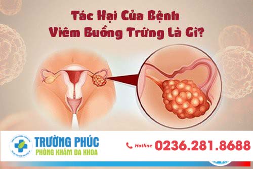 Viêm buồng trứng có thể biểu hiện dưới dạng cấp hoặc mãn tính