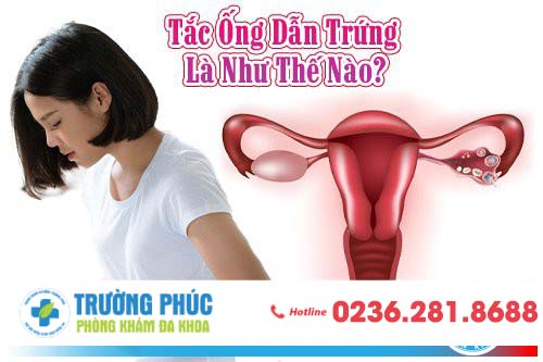 Hình ảnh ống dẫn trứng bình thường và ống dẫn trứng bị tắc
